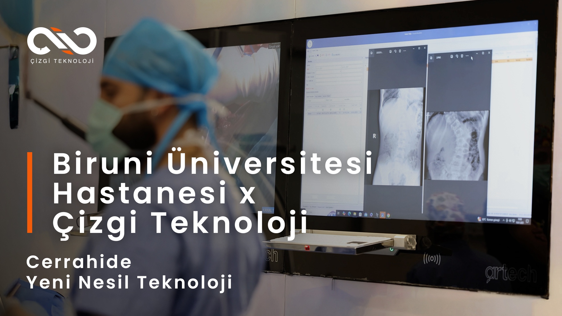 Biruni Üniversitesi Hastanesi x Çizgi Teknoloji | Cerrahide Yeni Nesil Teknoloji