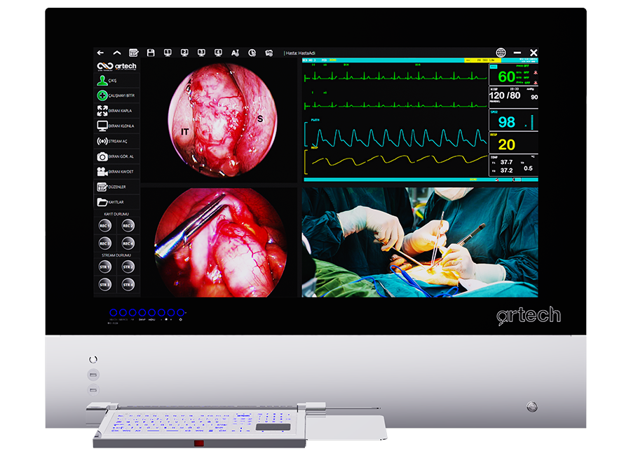 Ameliyathane Entegrasyon Sistemi - Dijital Negatoskop & Teletıp Sistemi