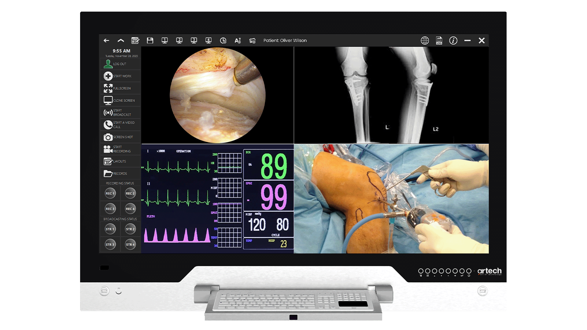 OR Integration System - Digital Negatoscope & Telemedicine System